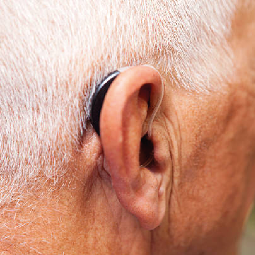 Small Behind The Ear Hearing Amplifier